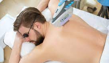 Everything You Need To Know About Laser Hair Removal For Men